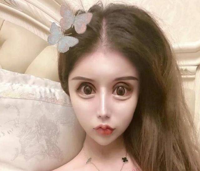 13岁女孩"沉迷整容",3年整了60多次,如今的五官令人一言难尽_审美