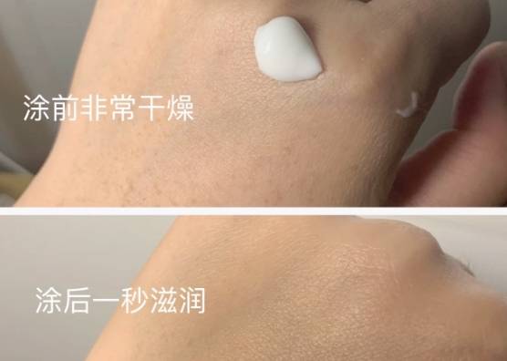 被药监局曝光的"有毒"面霜,风险大易感染,宝妈居然还给宝宝用_皮肤