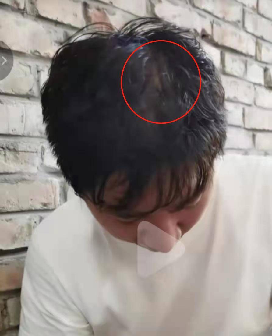 原创陈佩斯孙女近照祖孙四代共用一张脸发量稀疏都可见头皮