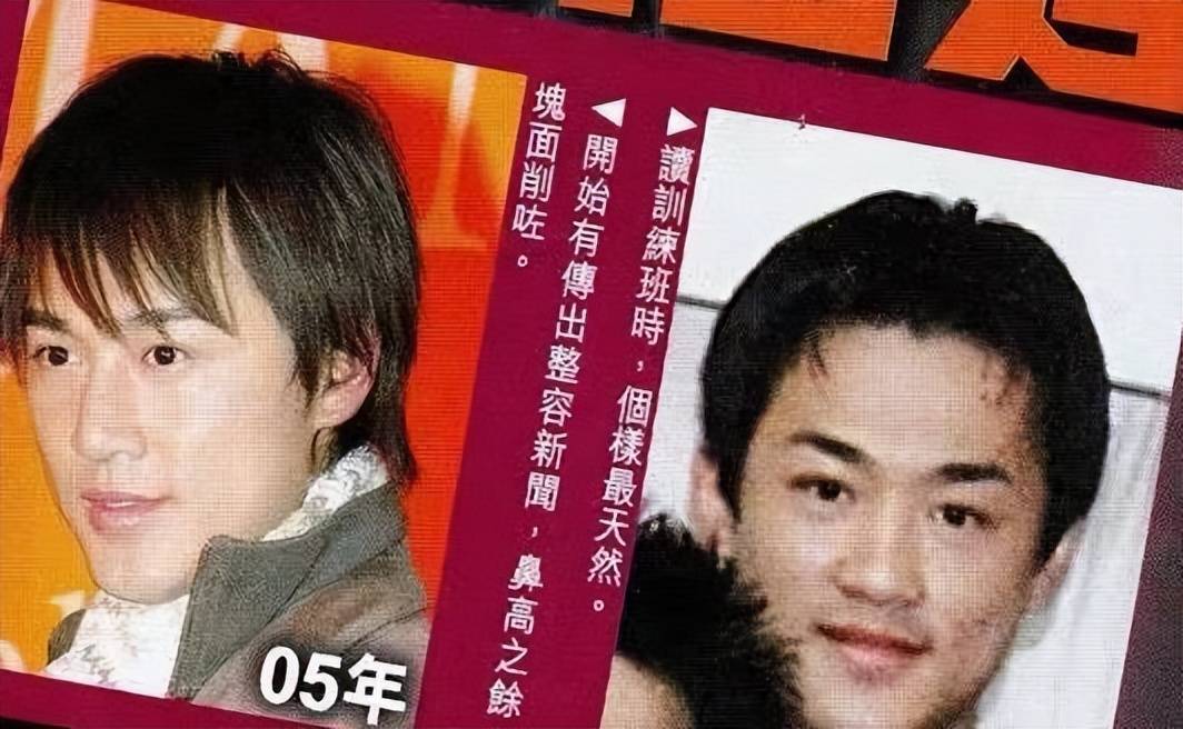 林峯从小时候到入行后,高额头也一直是他的标志,只是之前会用刘海遮挡