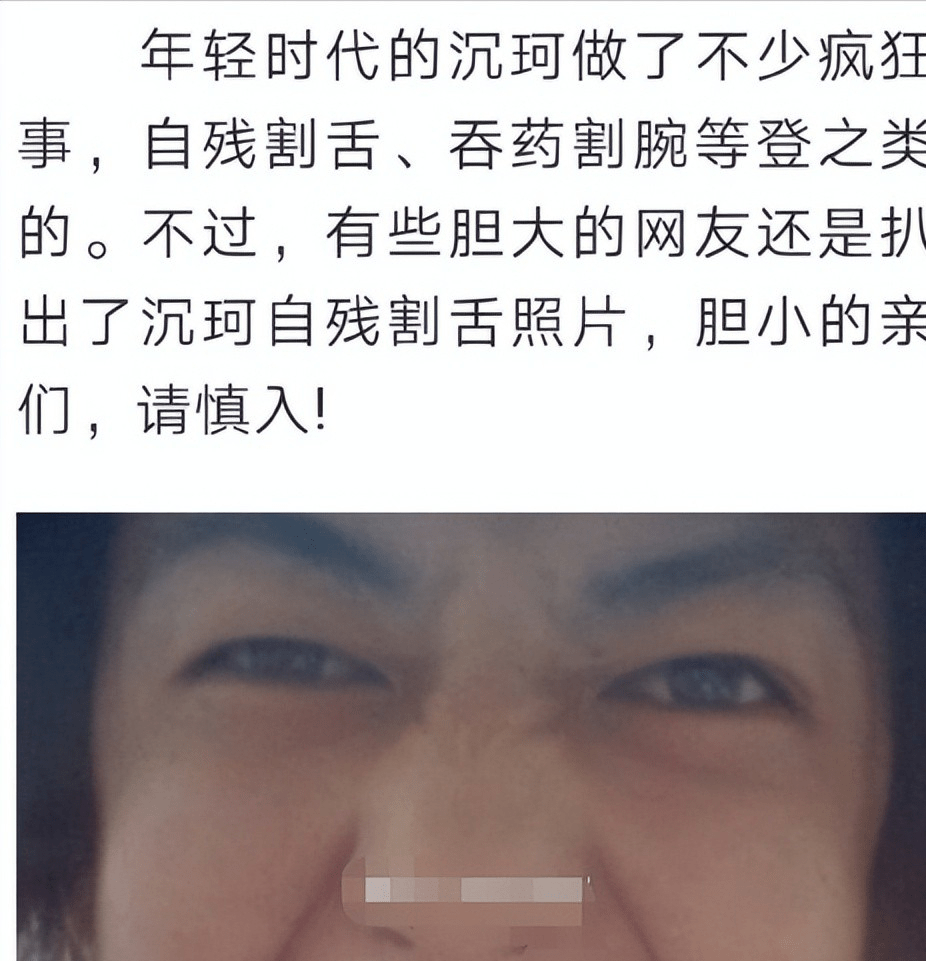 ck沉珂的自残照片的简单介绍