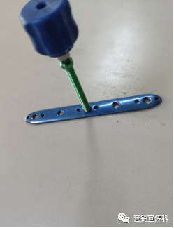 医声医事糖尿病足治愈啦菏泽市立医院顺利开展首例骨膜牵张手术