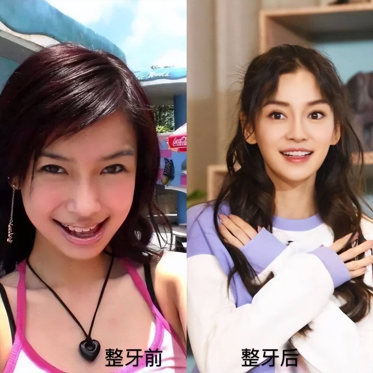 原创整牙变美再添一人赵丽颖亮相被质疑整容撞脸张馨予本人霸气回应刚