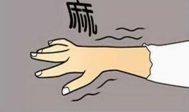 手部麻木不都是颈椎病 来了解腕管综合征 教你自测和治疗 神经 正中 手指