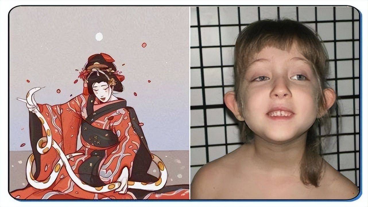 歌舞伎脸谱综合症图片