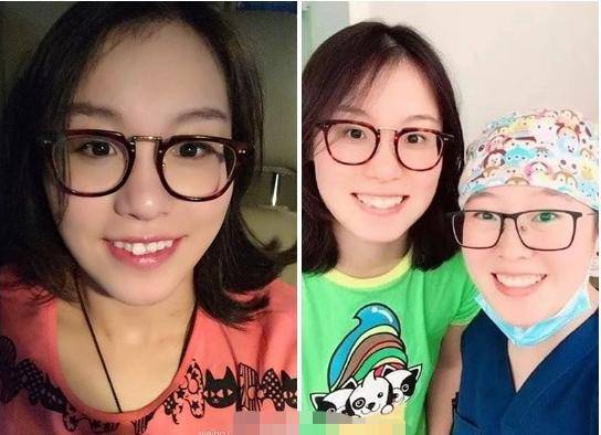 傅园慧整牙前后判若两人,堪比"整容",网友:美得认不出_孩子_牙齿_父母