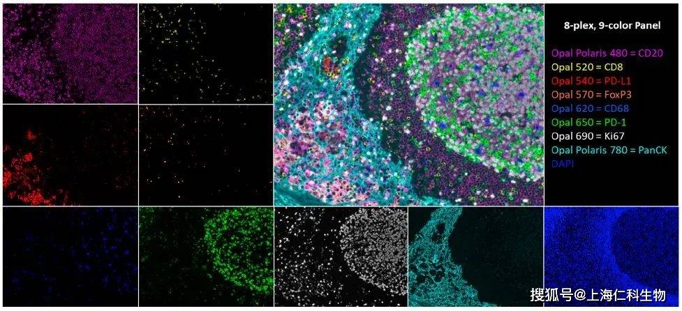 靶标分子检测 | 多重免疫荧光染色检测分析方案_Opal_肿瘤_进行