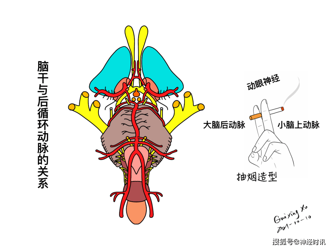 脑干与颅神经的解剖与临床