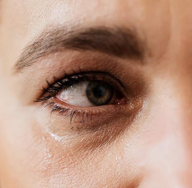 双眼灼热,畏光,爱流泪?当心流行性角结膜炎