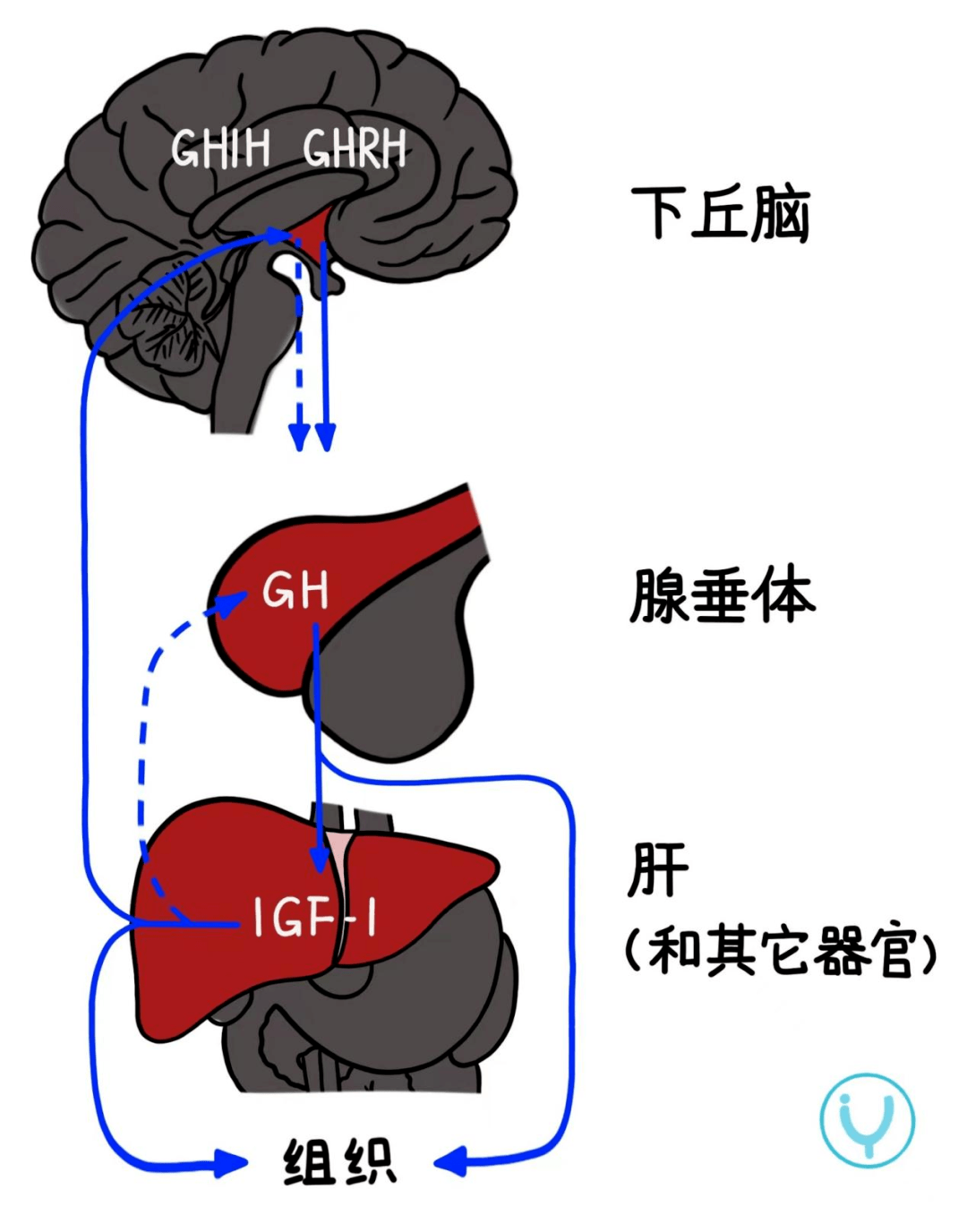 有一些特徵表明下丘腦-垂體功能障礙,如低血糖症,陰莖,隱睪症,視神經