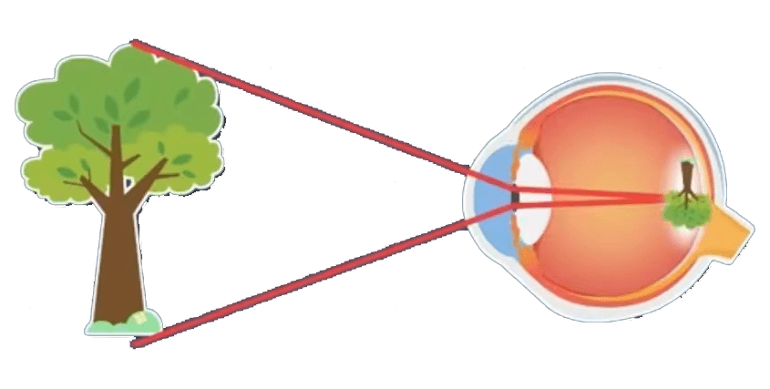 近视视网膜成像图片