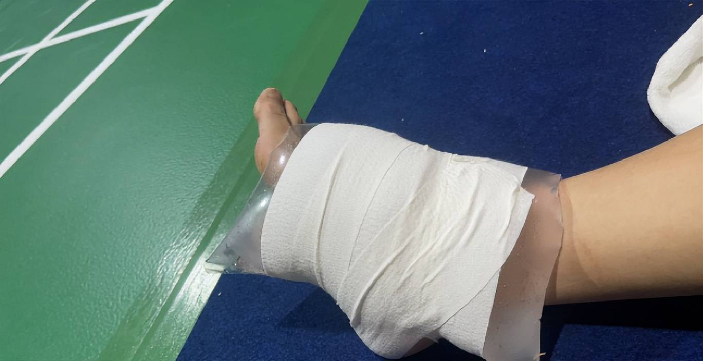 原创心疼陈雨菲把脚裹成粽子赛后首次发声再为张军和罗毅刚解围