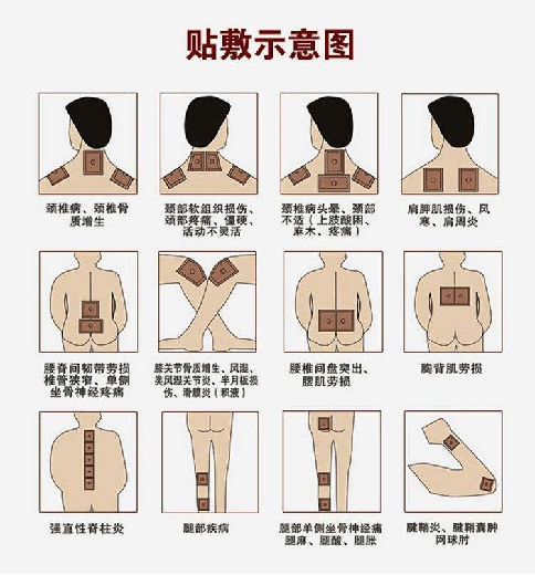 热敷老膏图片 背部图片