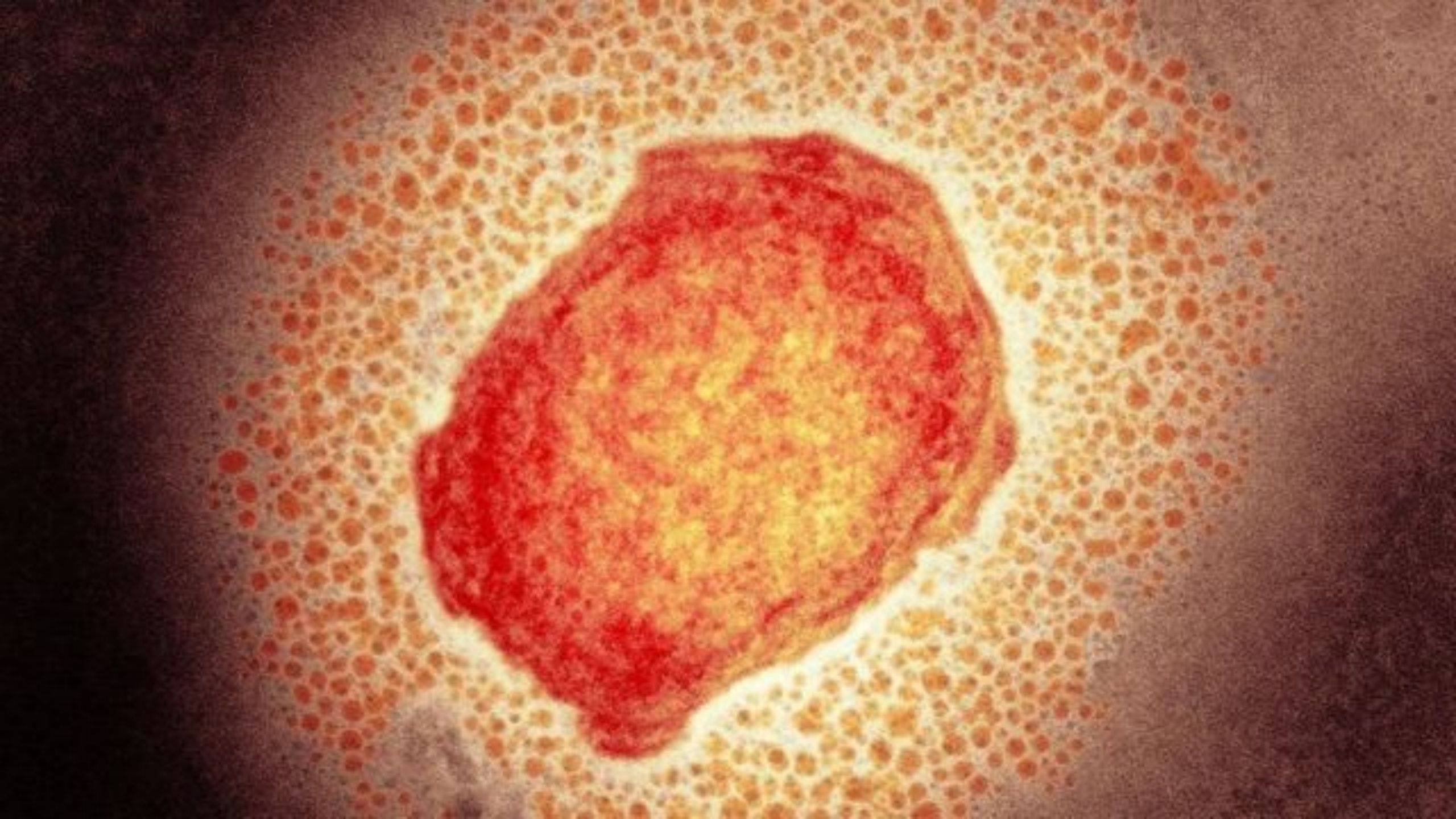 什么是猴痘：症状、传播、防疫等你可能想了解的问题