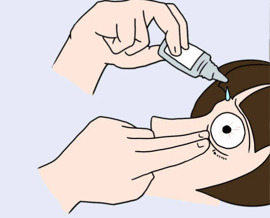 西班牙ross联合治疗法——眼部护理联合小电棒 搭桥疗法进行眼部护理