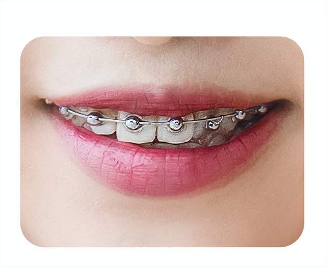 自制冰墩墩野生球托二次创作需注意专利保护