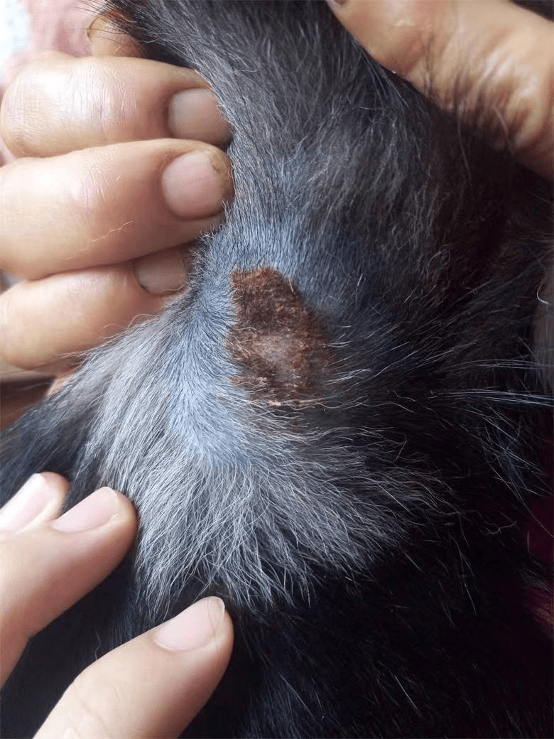 可能出现甲沟炎,伴有褐色的甲床分泌物.