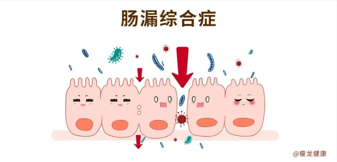 什么是肠漏肠道有个洞吃什么可以修复肠漏