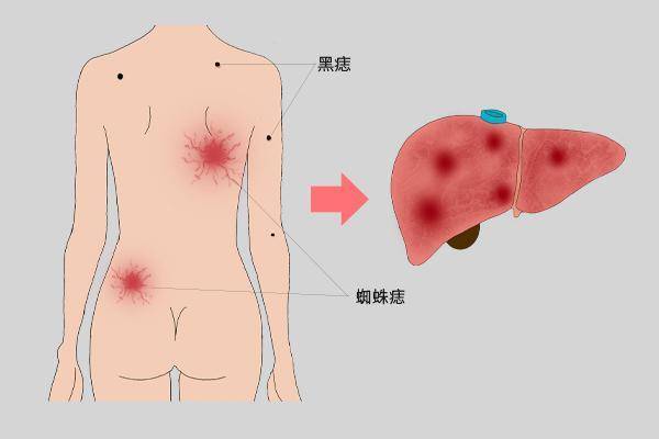 超级养肝王终于出现若你喜欢口臭黄斑不会来找你