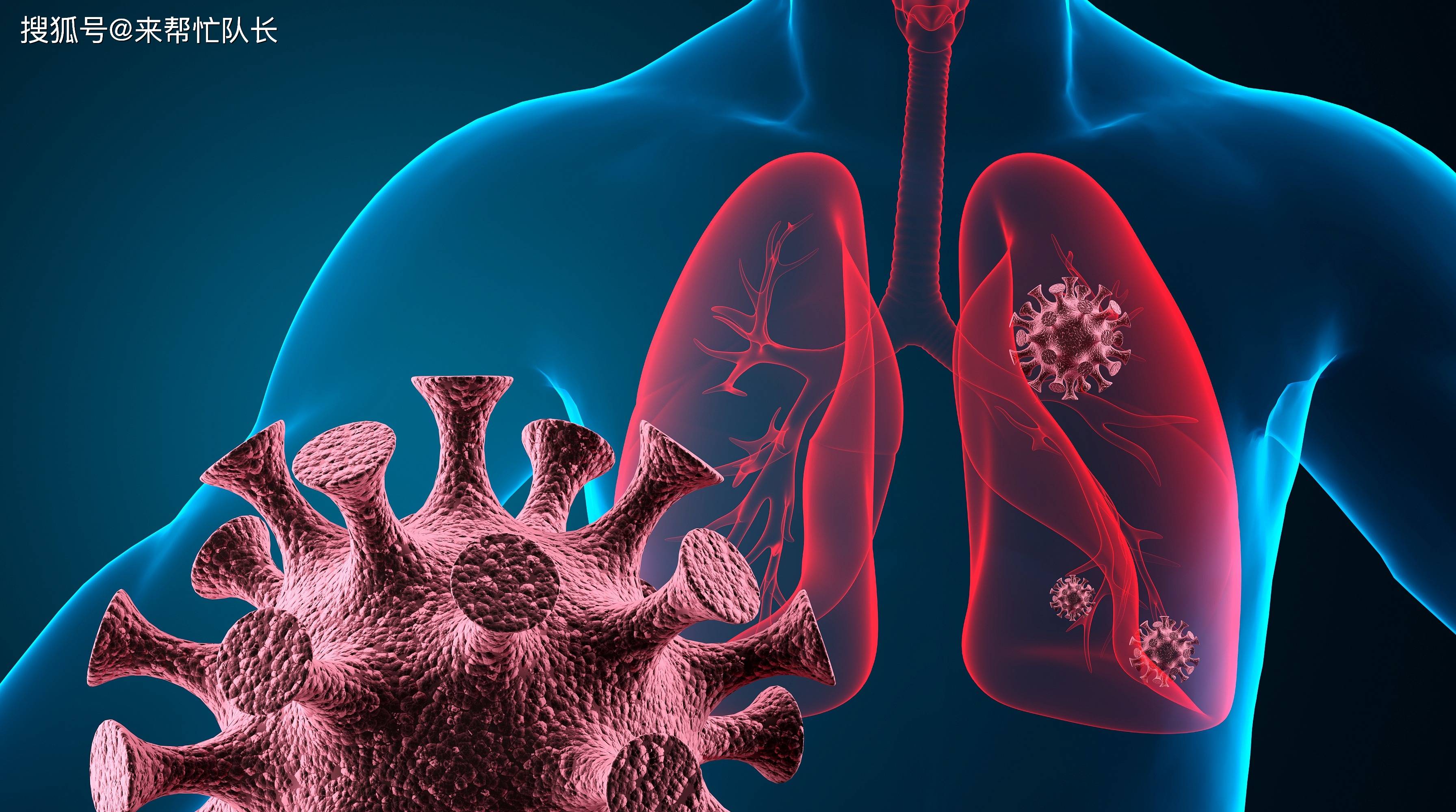 “咳白痰”查出肺癌晚期！深圳有把“射波刀”，不开刀也能“切”|放疗科|肺癌|射波|晚期|肿瘤|射线|癌症|-健康界