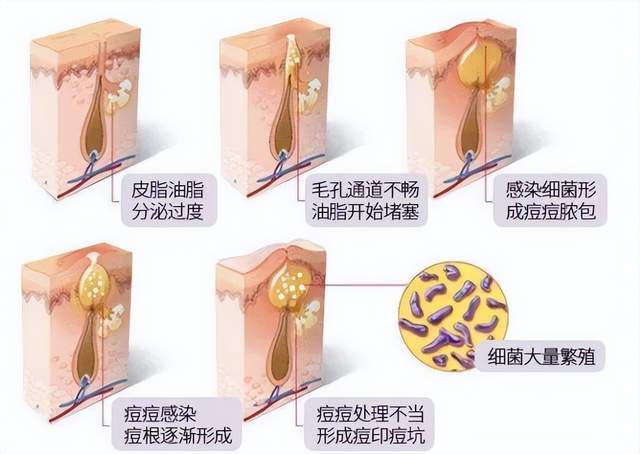 水媚蛙:明明脸上花钱最多,为啥皮肤最差?