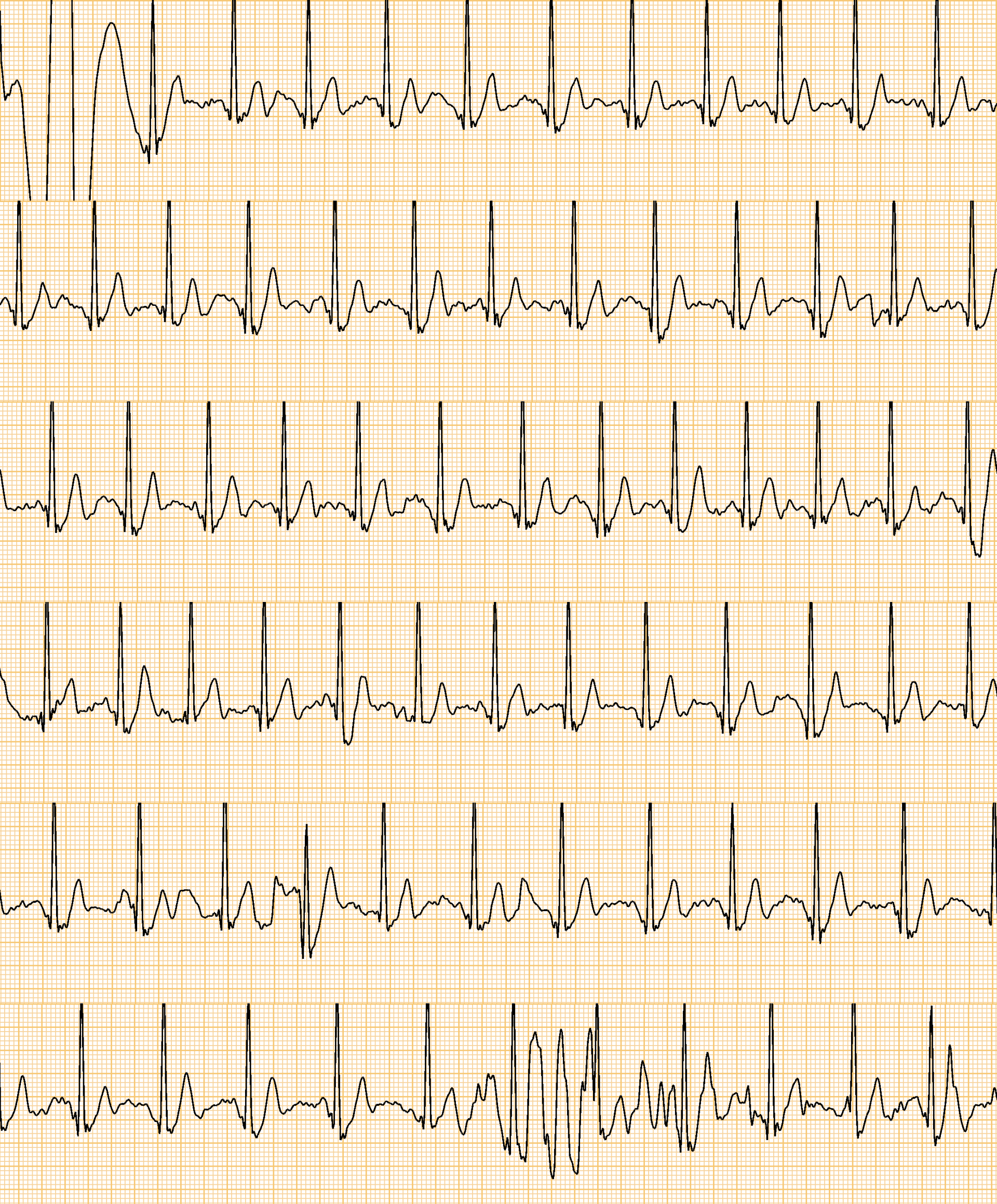 Ͻܼ,dido E10Ѫѹĵֱ,ػ,ֵӵ