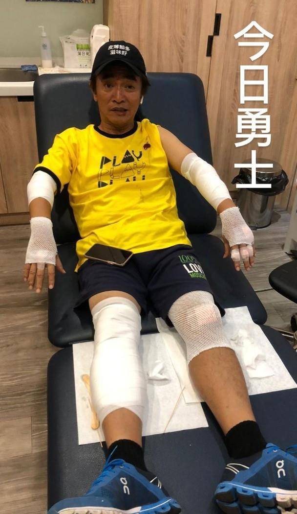 吴宗宪出车祸头盔全碎,四肢包扎还要做脑检查,事发惊险画面曝光