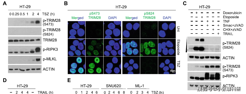 trim28的ripk3依賴性磷酸化誘導轉錄活性增強免疫熒光染色顯示s473
