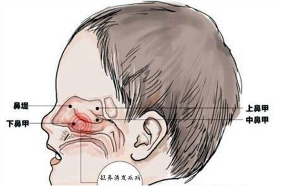 鼻子总疼，很有可能是这些问题！_原因_感觉_治疗