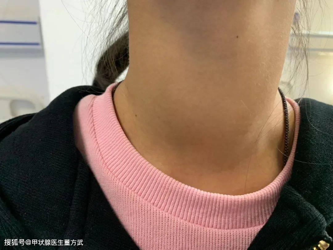 了解一下得甲状腺癌的人的6个"共性"_女性_国家癌症中心_男性