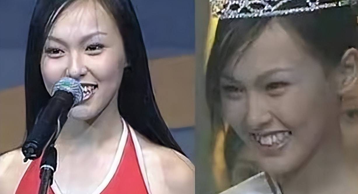 龅牙,假牙,大板牙,这12位女星貌美如花,却都"输"在了牙齿上