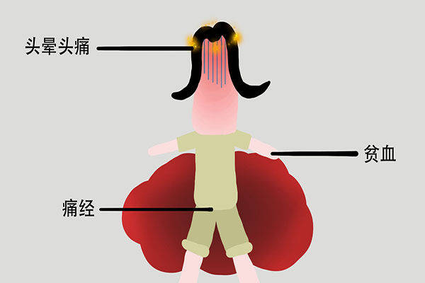 一个子宫不好的女性,月经会有哪些变化?医生教您从月经看子宫_经血_时候_颜色
