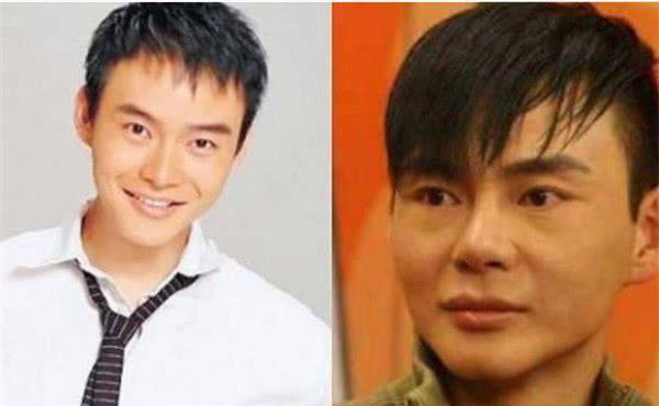原创大方承认自己整容的四位男星第一位成毁容最后一位为艺术