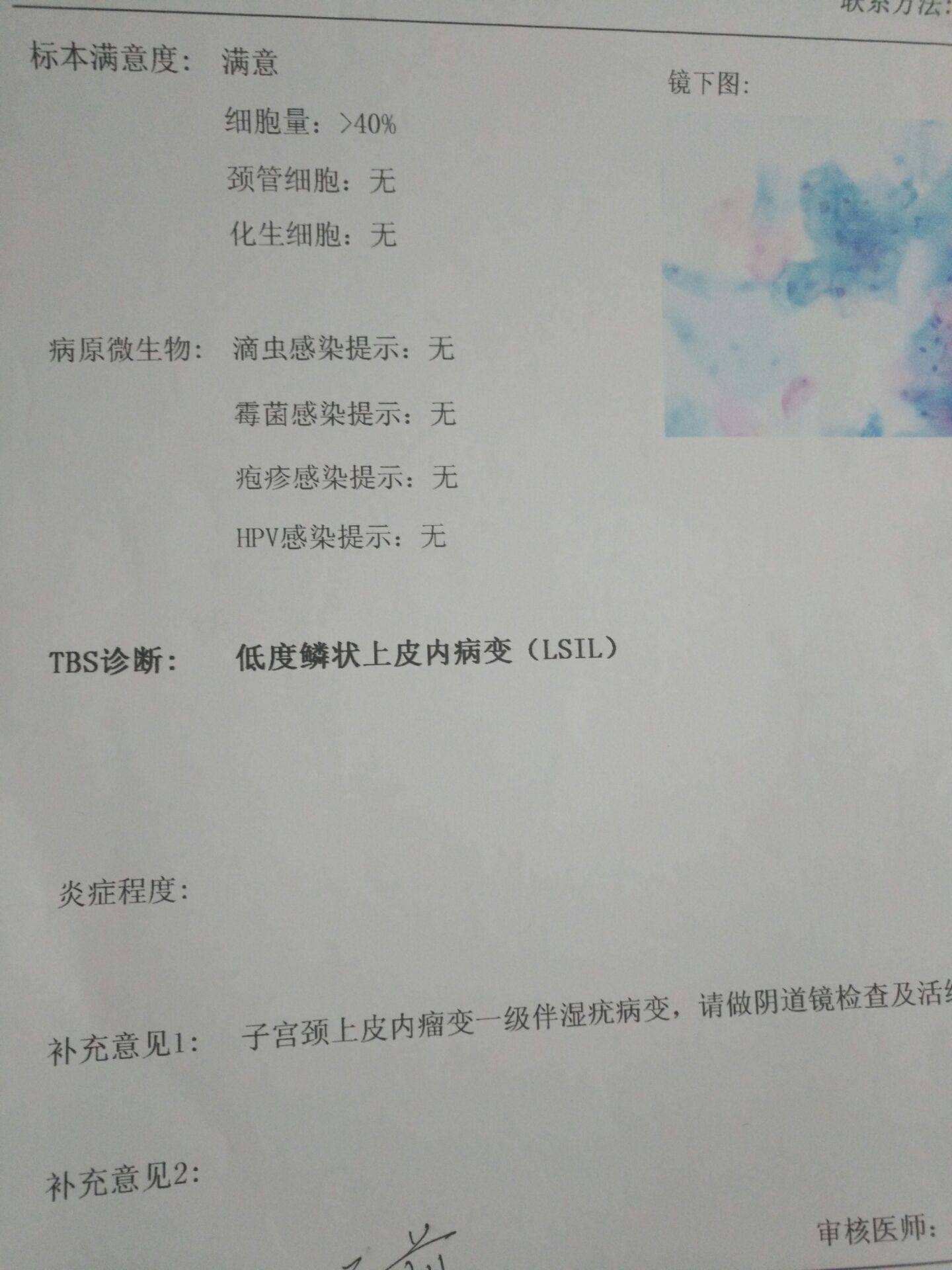 鼻咽癌活检报告单图片