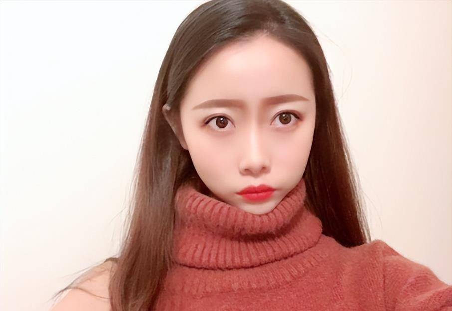 19年,四川21岁女孩被大火烧伤,全脸毁容双臂截肢,928天后重生_乔燕