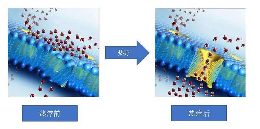 热疗登上热搜无创无痛无毒的肿瘤热疗新技术你了解吗