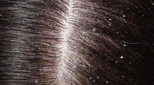 头发_效果_细菌