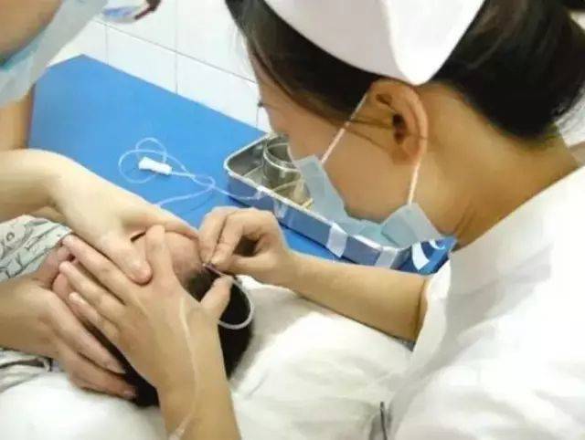静脉输液一般都是打哪几个部位?针头的质量又该如何质检呢?