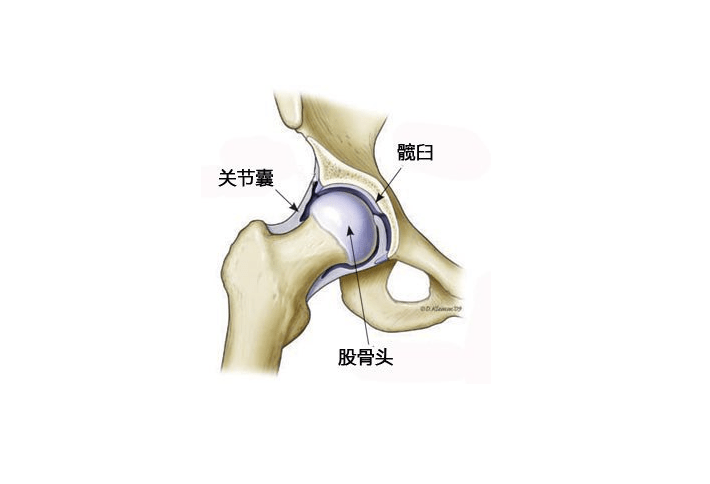 髋关节滑膜炎的症状图片