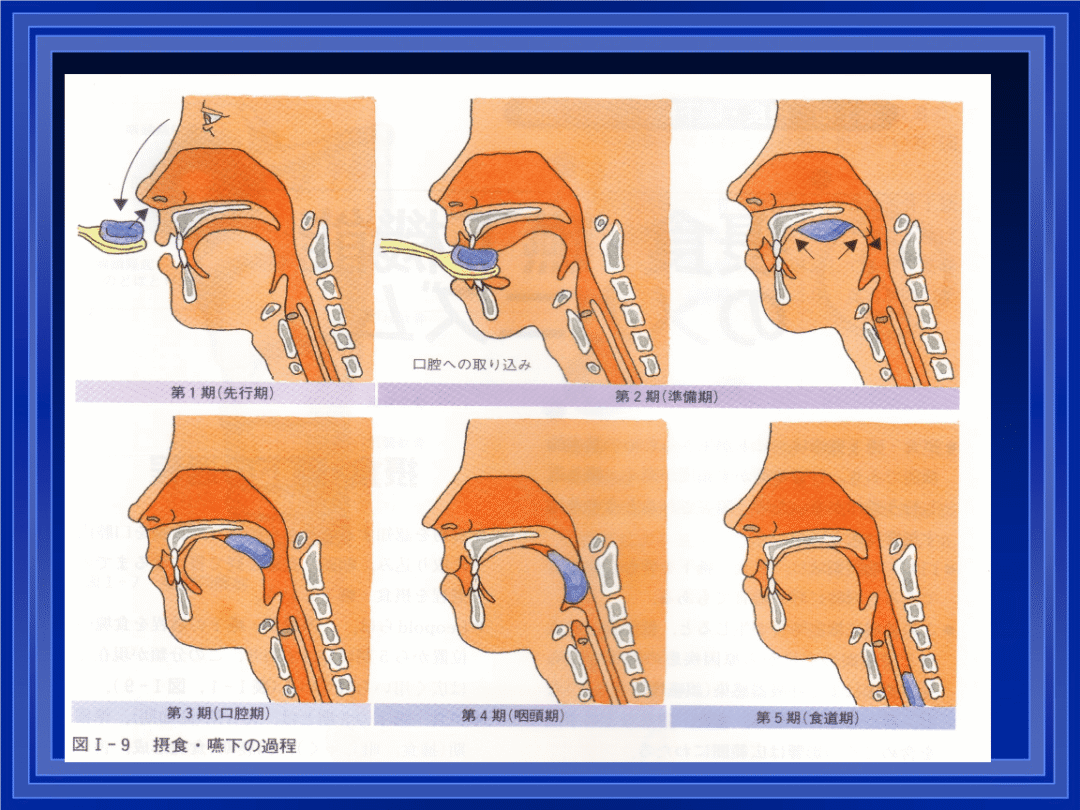 吞咽动作不简单，别把“吞咽困难”不当回事 训练 食物 咽部