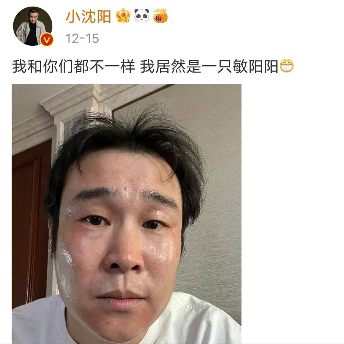 疫情之下,众生平等,12位名人被感染后,反应各不同,你呢？