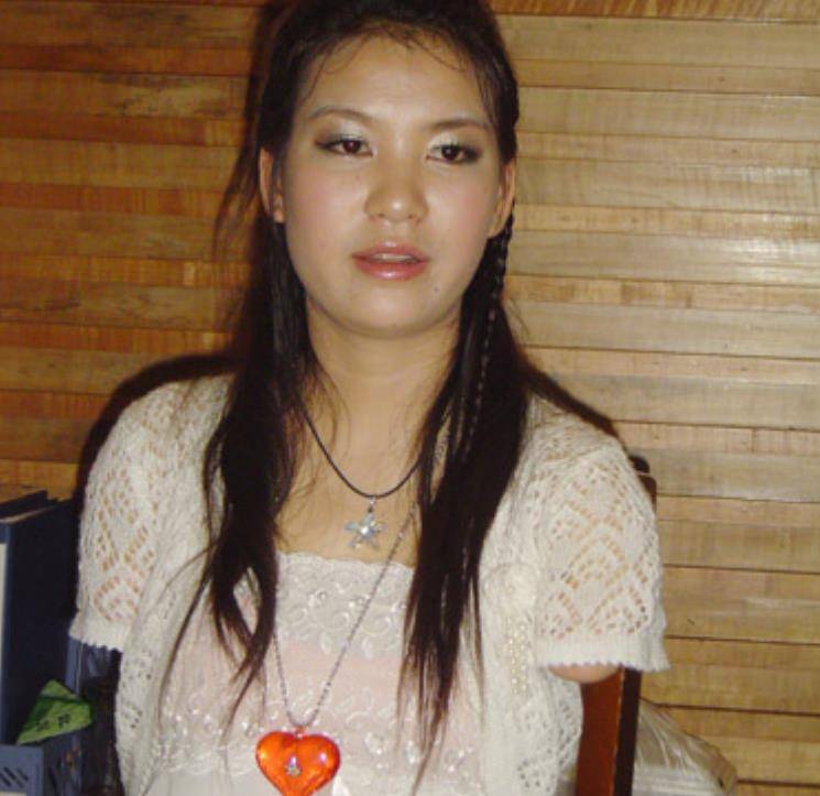 中的这个角色与雷庆瑶有着异曲同工之妙,同样都是因为意外失去双臂,都