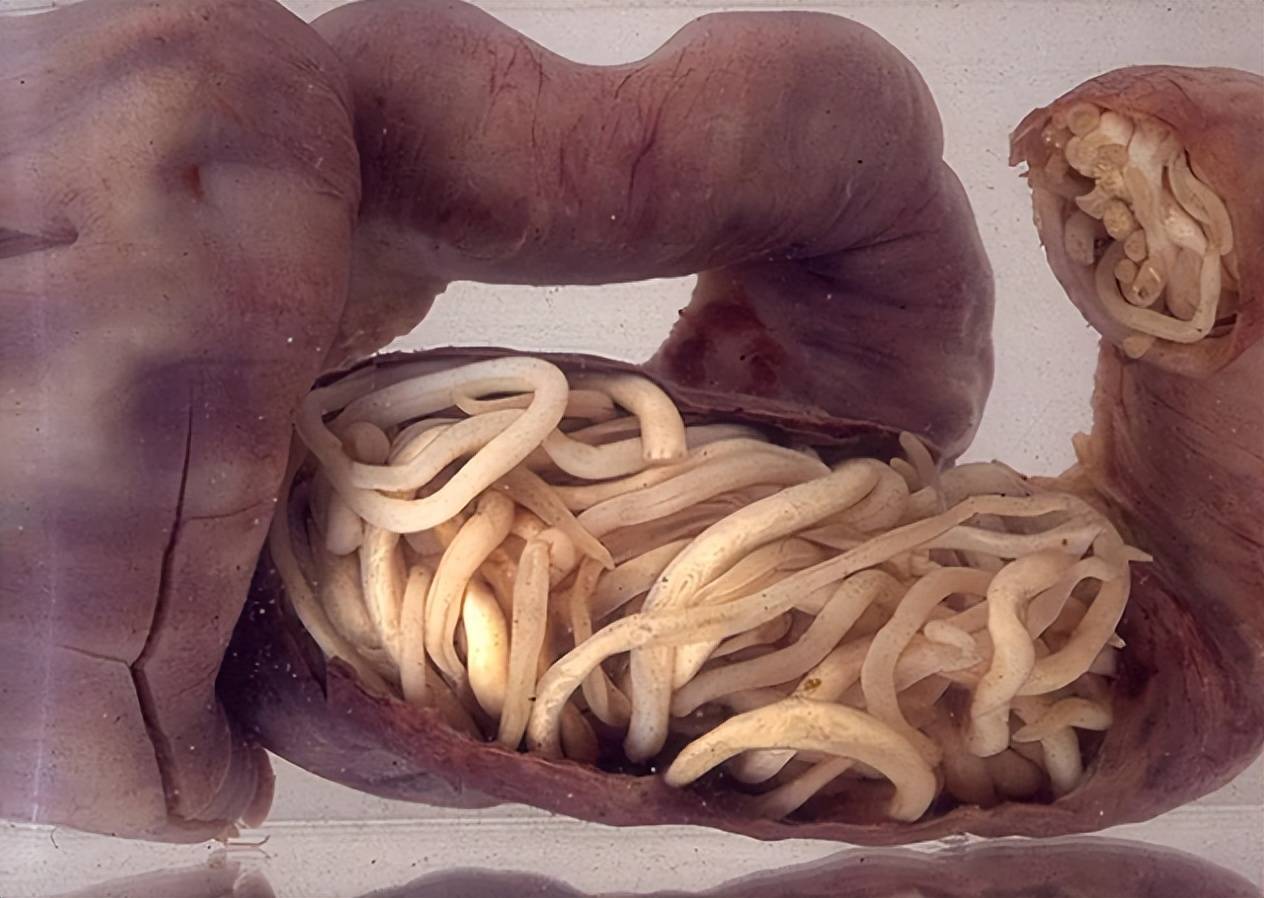 科学家以身试吃,在"盛宴"中推进的蛔虫研究_实验_莫斯勒_寄生虫