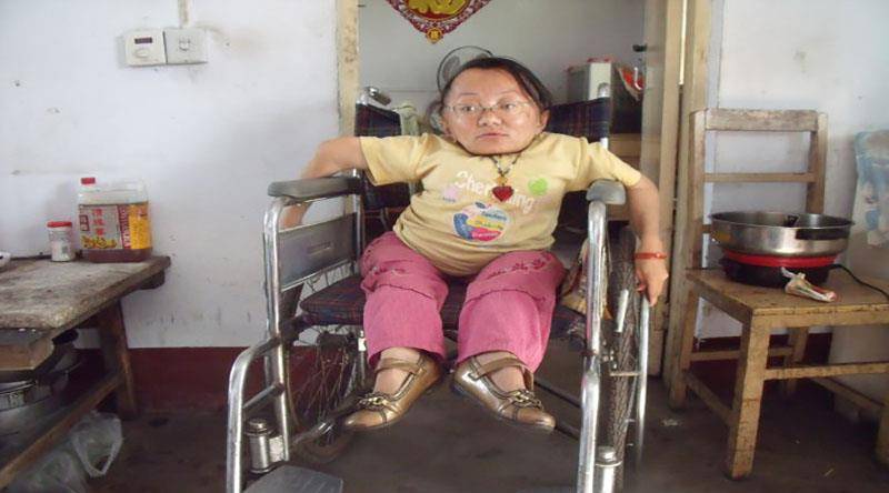 96厘米"瓷娃娃"妈妈痛失爱子,收养残疾弃婴相依为命,感动无数人