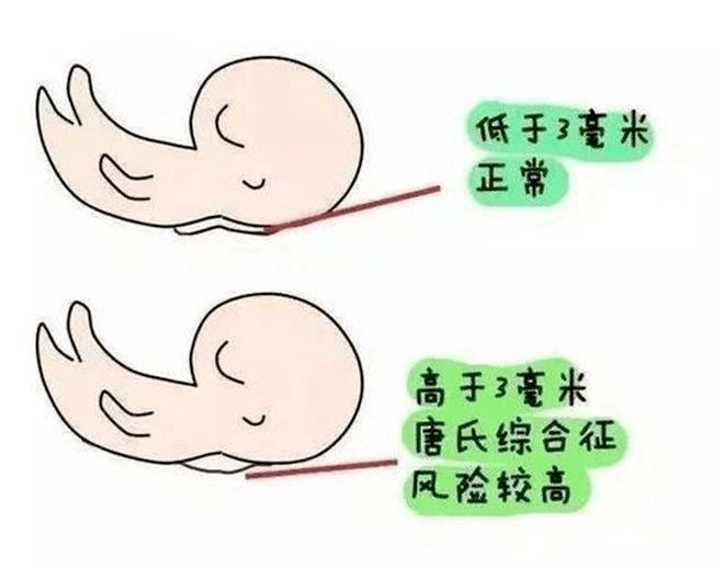 墙裂推荐（抽血化验怀孕图片恶搞）抽血化验怀孕检查报告单图片真实 第6张