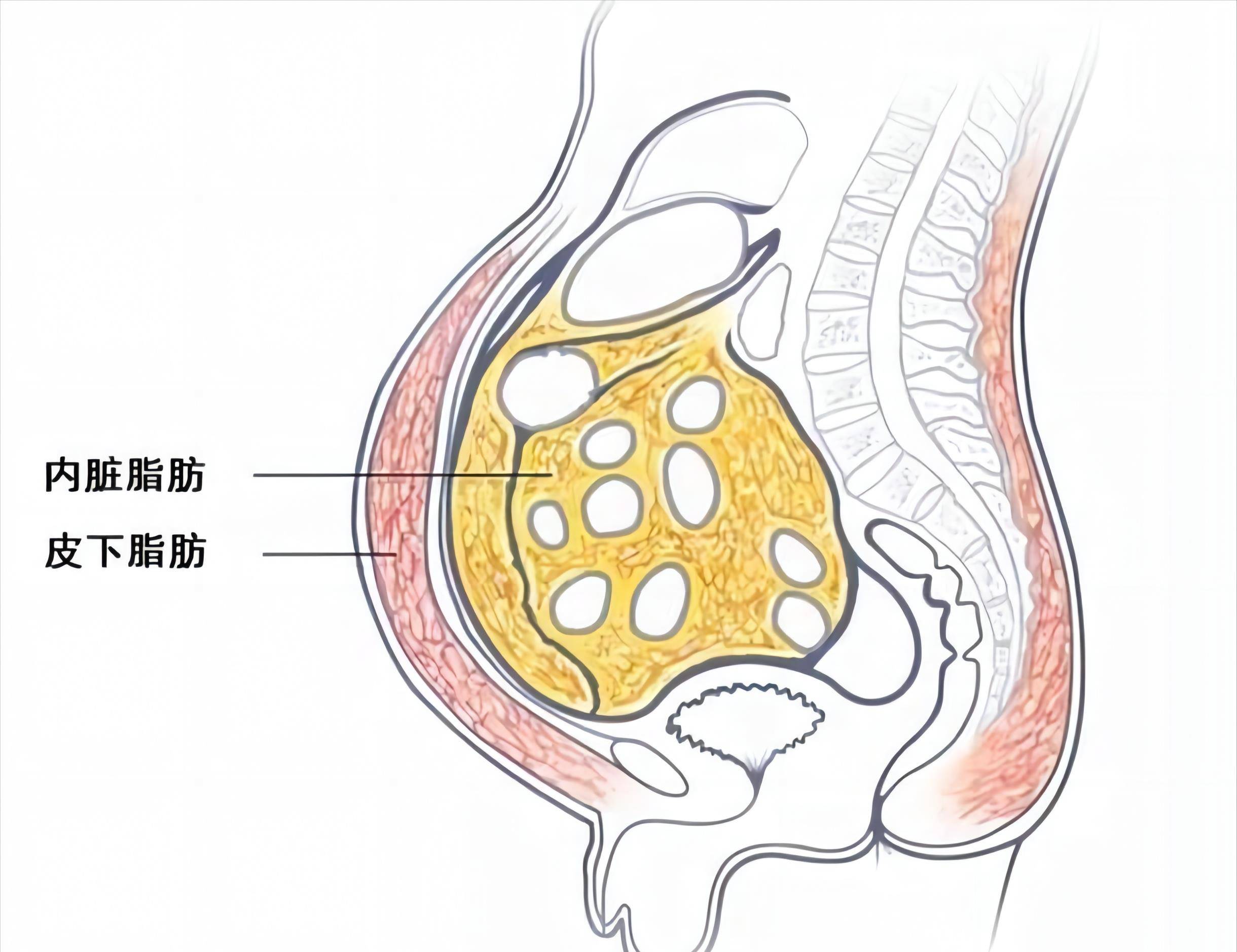 该怎么减?医生分享两个方法_减肥_脂肪_内脏