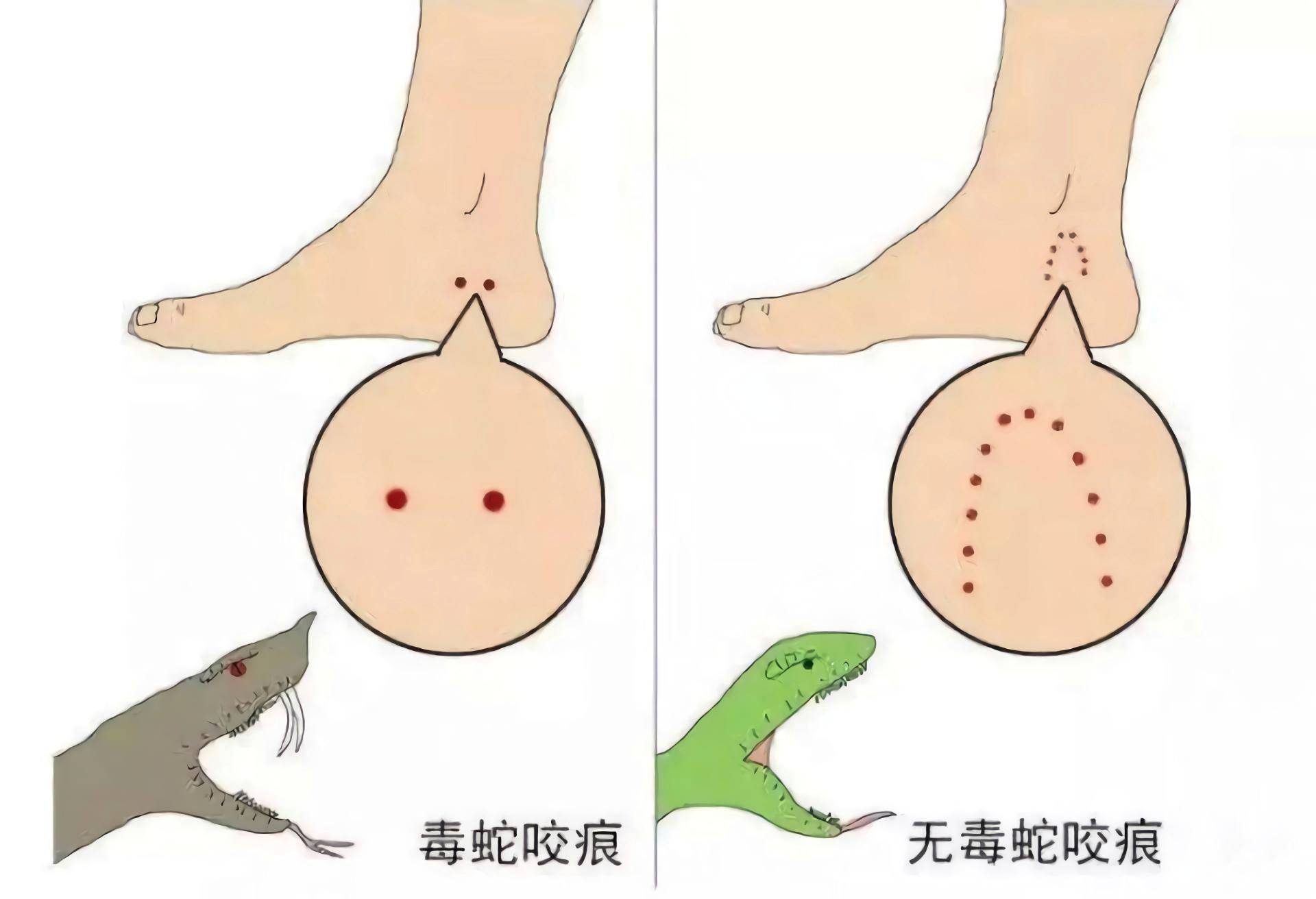打蛇打七寸,蛇的弱点在哪?_心脏_部位_毒蛇