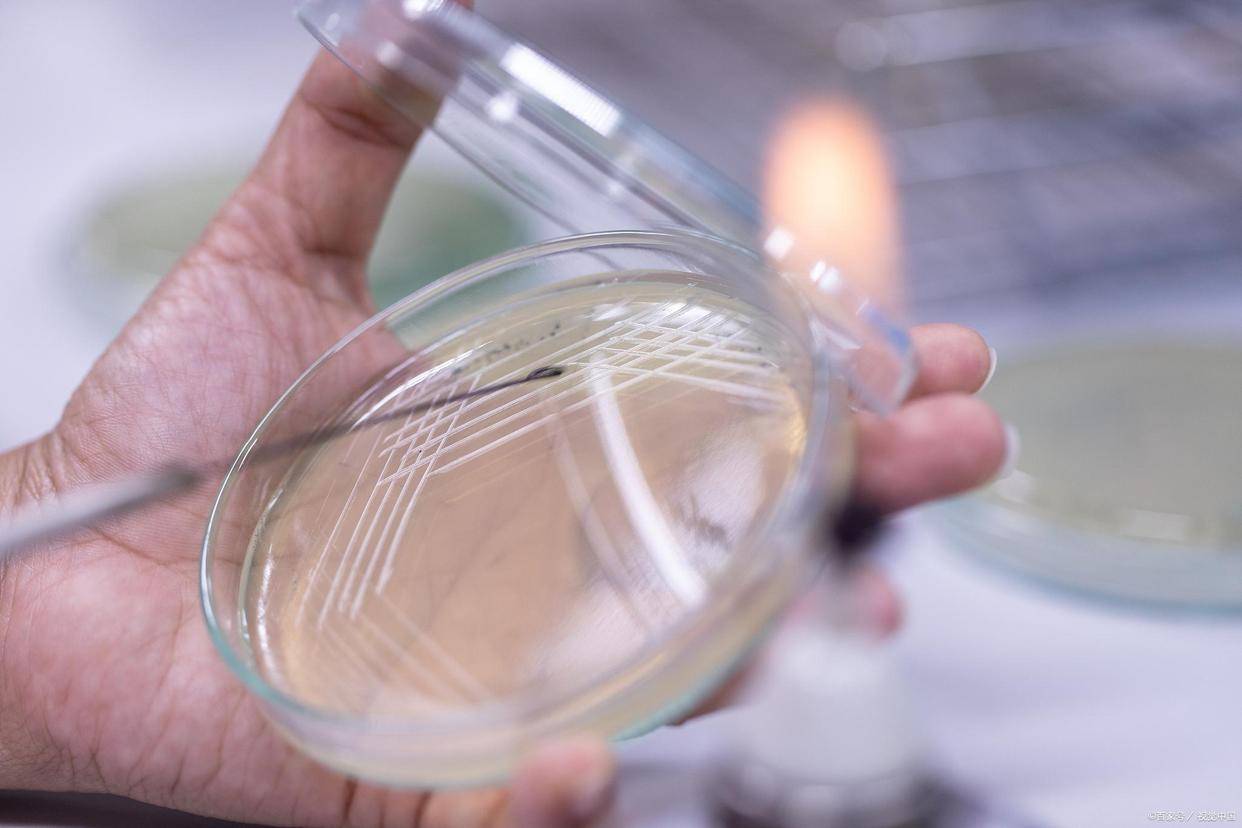 器皿_培养基_微生物