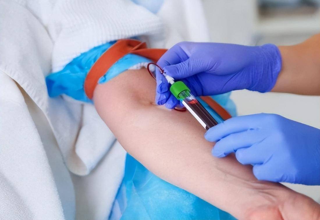 为什么一到医院就要抽血?