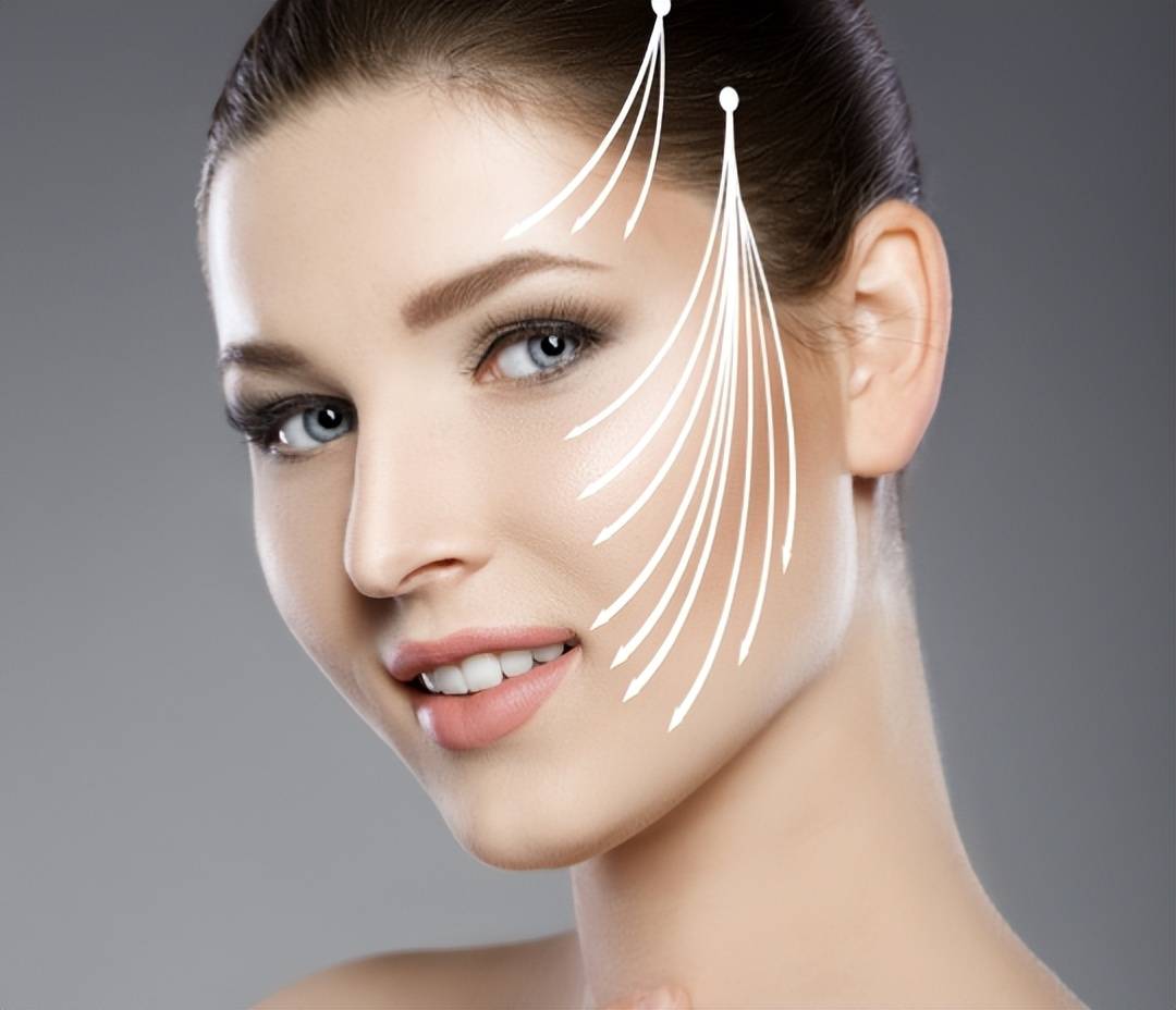 聊一聊:三线提升和线雕的区别,三线提升和线雕哪个效果好?